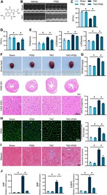 Pyrroloquinoline quinone modulates YAP-related anti-ferroptotic activity to protect against myocardial hypertrophy